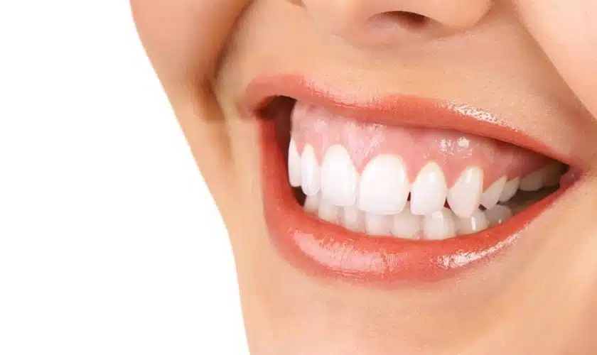 Is Your Smile Showing a Little Too Much Gum?