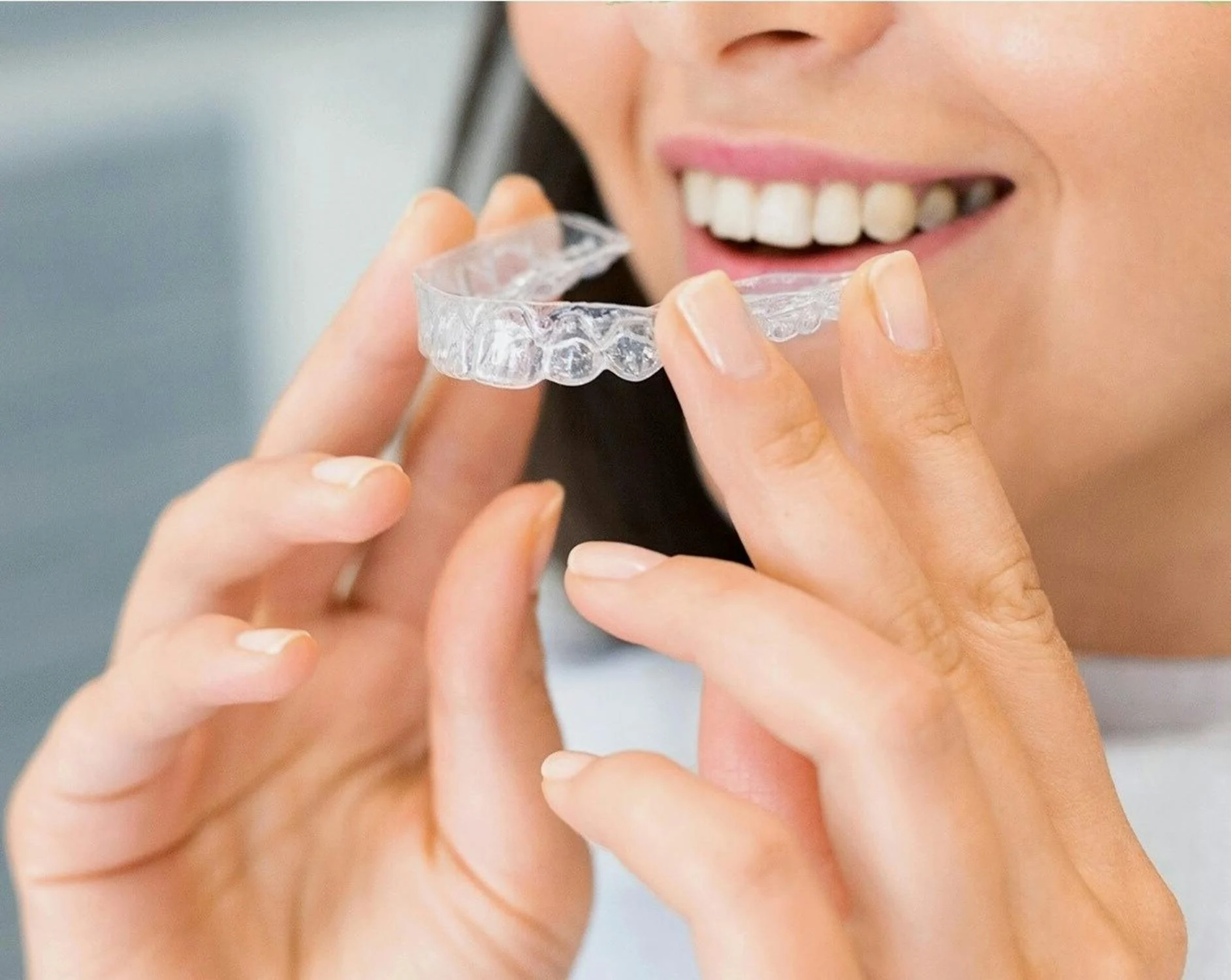 Everything You Need to Know About Clear Aligners